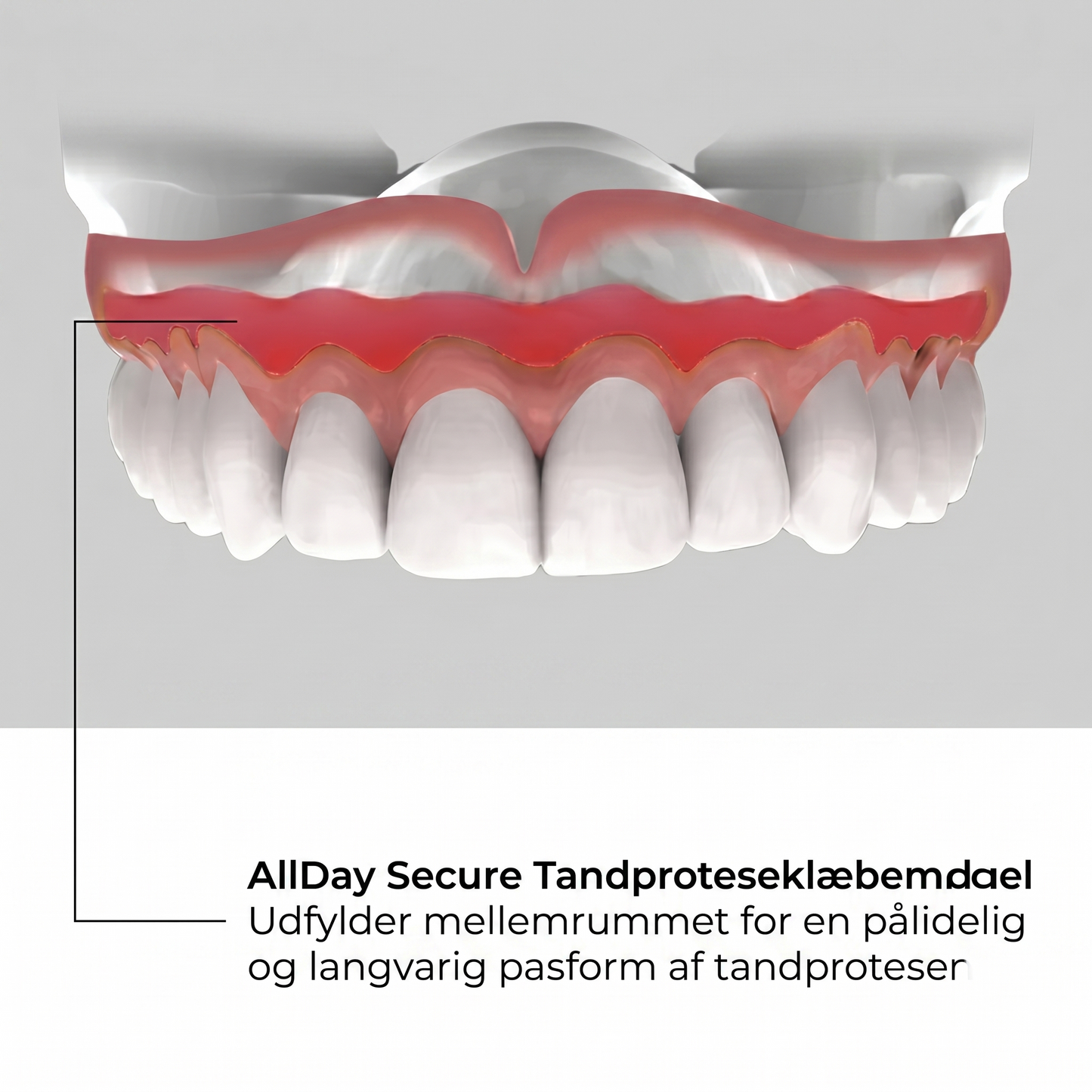 Allday Secure – stærk proteseklæber