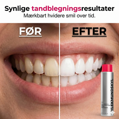 Pletfjernende whitening-mundskyl