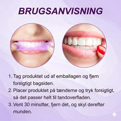 Tandblegningsstrips